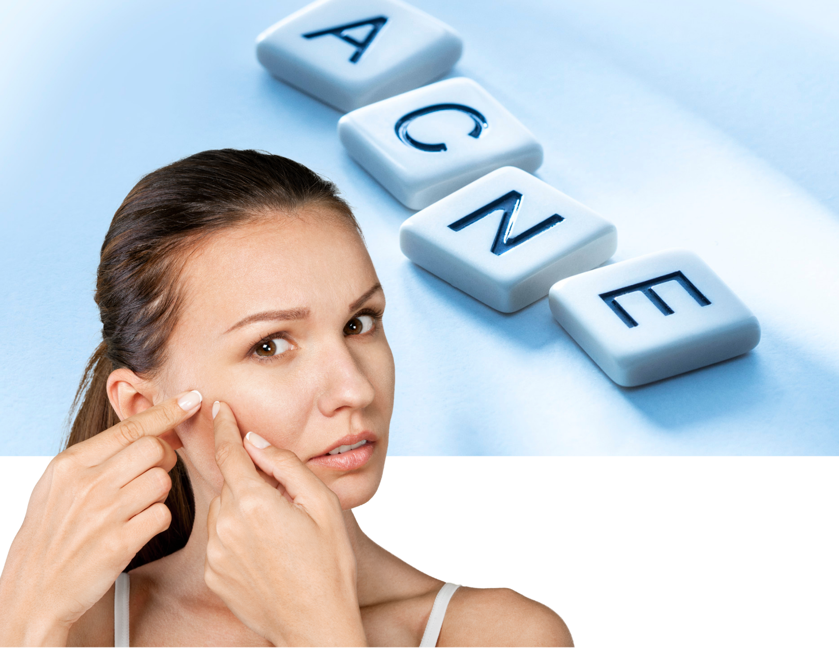 Nutritional Tips for Managing Acne